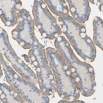 Immunohistochemistry-Paraffin: PSMA/FOLH1/NAALADase I Antibody [NBP1-89822]