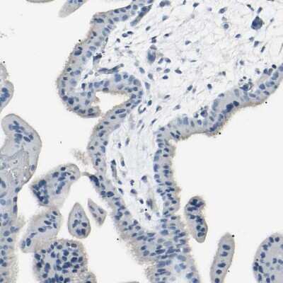 Immunohistochemistry-Paraffin: PSMA/FOLH1/NAALADase I Antibody [NBP1-89822]