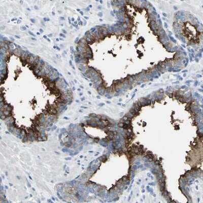 Immunohistochemistry-Paraffin: PSMA/FOLH1/NAALADase I Antibody [NBP1-89822]