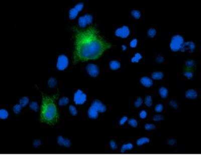 Immunocytochemistry/ Immunofluorescence: PSMA/FOLH1/NAALADase I Antibody (OTI3H5) - Azide and BSA Free [NBP2-73686]