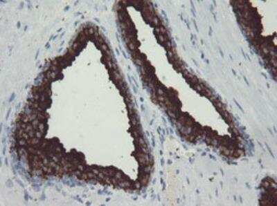 Immunohistochemistry-Paraffin: PSMA/FOLH1/NAALADase I Antibody (OTI3H5) - Azide and BSA Free [NBP2-73686]