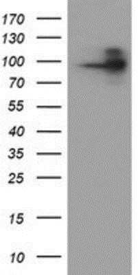 Western Blot: PSMA/FOLH1/NAALADase I Antibody (OTI3H5)Azide and BSA Free [NBP2-73686]