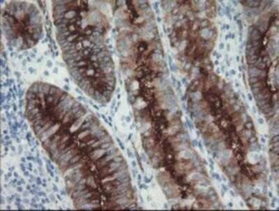 Immunohistochemistry-Paraffin: PSMA/FOLH1/NAALADase I Antibody (OTI3H5) [NBP2-02045]