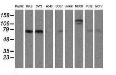 Western Blot: PSMA/FOLH1/NAALADase I Antibody (OTI3H5) [NBP2-02045]