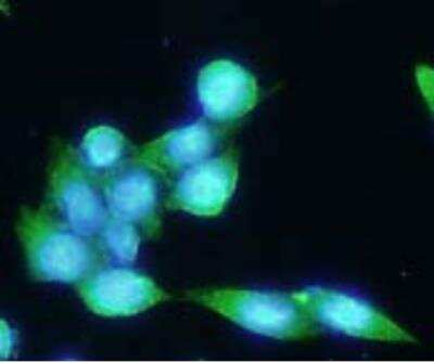 Immunocytochemistry/ Immunofluorescence: PSMA/FOLH1/NAALADase I Antibody (k1H7) - BSA Free [NBP1-04338]