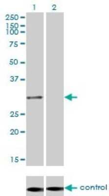 Western Blot: PSMA1 Antibody (1D9-1C7) [H00005682-M01]