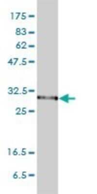 Western Blot: PSMA1 Antibody (1D9-1C7) [H00005682-M01]