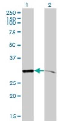 Western Blot: PSMA1 Antibody (1D9-1C7) [H00005682-M01]