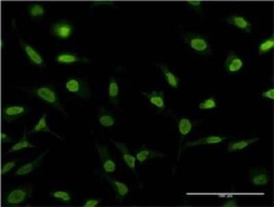 Immunocytochemistry/ Immunofluorescence: PSMA1 Antibody (3F12-2C9) [H00005682-M02]