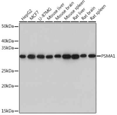 Western Blot: PSMA1 Antibody (5X3A6) [NBP3-16190]