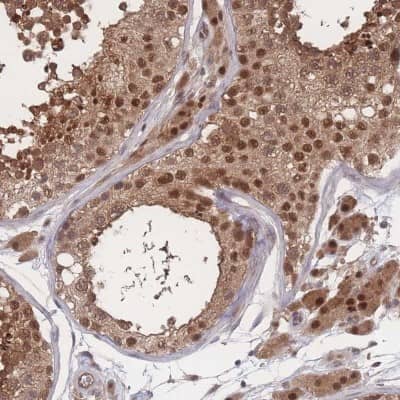 Immunohistochemistry-Paraffin: PSMA1 Antibody [NBP2-37908]