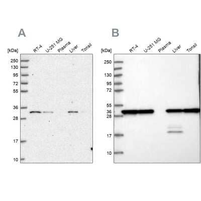 Western Blot: PSMA1 Antibody [NBP2-37908]