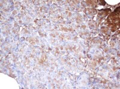 Immunohistochemistry: PSMA2 Antibody (OTI3D9) [NBP2-45418]