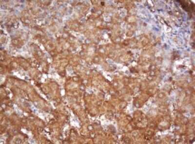 Immunohistochemistry: PSMA2 Antibody (OTI3D9) [NBP2-45418]
