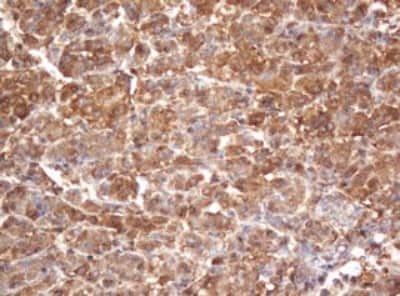 Immunohistochemistry: PSMA2 Antibody (OTI3D9) [NBP2-45418]