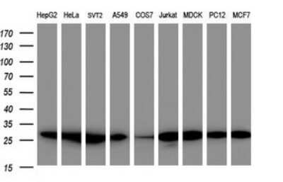 Western Blot: PSMA2 Antibody (OTI3D9) [NBP2-45418]