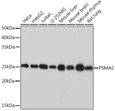 Western Blot: PSMA2 Antibody (6L5H4) [NBP3-16778]