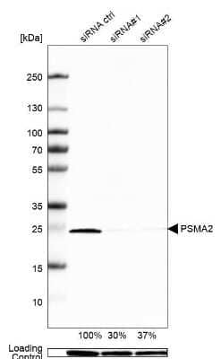 Western Blot: PSMA2 Antibody [NBP1-92292]