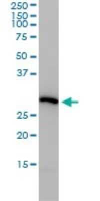 Western Blot: PSMA4 Antibody (2A10-E4) [H00005685-M01]