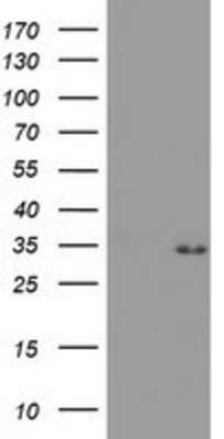 Western Blot: PSMA4 Antibody (OTI4B8) [NBP2-01608]