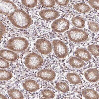Immunohistochemistry-Paraffin: PSMA4 Antibody [NBP2-38754]