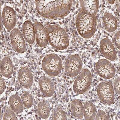 Immunohistochemistry-Paraffin: PSMA4 Antibody [NBP2-38894]