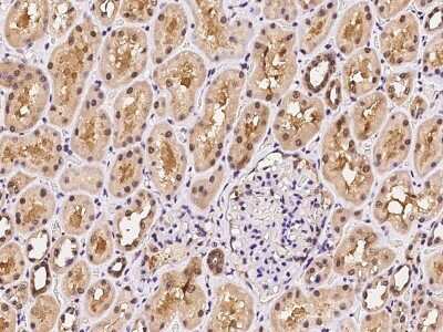 Immunohistochemistry-Paraffin: PSMA4 Antibody [NBP2-99610]