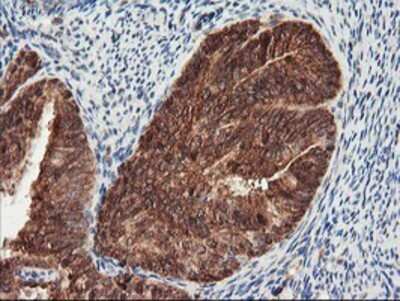 Immunohistochemistry: PSMA4 Antibody (OTI4B8) - Azide and BSA Free [NBP2-73690]