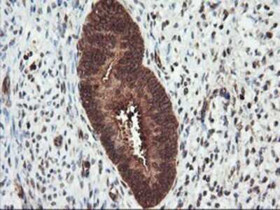 Immunohistochemistry: PSMA4 Antibody (OTI4B8) - Azide and BSA Free [NBP2-73690]