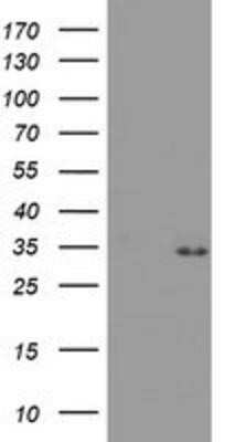 Western Blot: PSMA4 Antibody (OTI4B8)Azide and BSA Free [NBP2-73690]