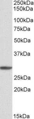 Western Blot: PSMA4 Antibody [NBP1-52074]