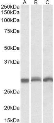 Western Blot: PSMA4 Antibody [NBP1-52074]