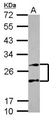 Western Blot: PSMA4 Antibody [NBP2-19982]