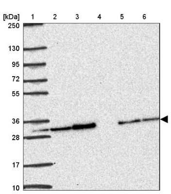 Western Blot: PSMA4 Antibody [NBP2-38754]