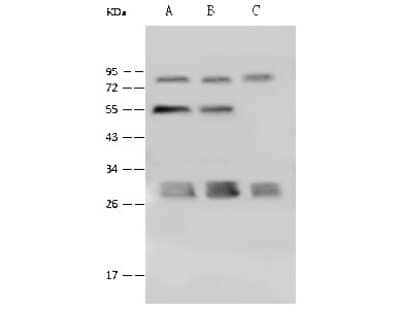 Western Blot: PSMA4 Antibody [NBP2-99610]