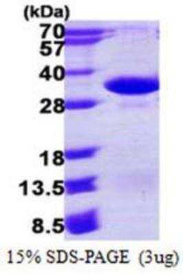 SDS-PAGE: Recombinant Human PSMA4 His Protein [NBP1-78849]