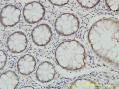 Immunohistochemistry-Paraffin: PSMA7 Antibody (1A10-3G12) [H00005688-M01]
