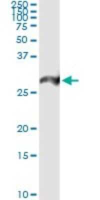 Immunoprecipitation: PSMA7 Antibody (1A10-3G12) [H00005688-M01]