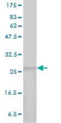 Western Blot: PSMA7 Antibody (1A10-3G12) [H00005688-M01]