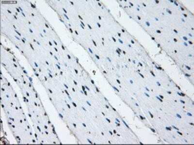 Immunohistochemistry-Paraffin: PSMA7 Antibody (OTI3F11) [NBP2-02120]