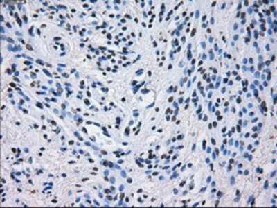 Immunohistochemistry-Paraffin: PSMA7 Antibody (OTI3F11) [NBP2-02120]