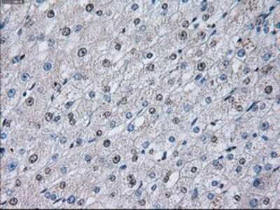Immunohistochemistry-Paraffin: PSMA7 Antibody (OTI3F11) [NBP2-02120]