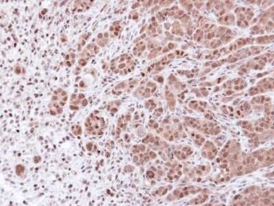 Immunohistochemistry-Paraffin: PSMA7 Antibody [NBP1-33539]