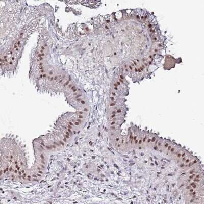 Immunohistochemistry-Paraffin: PSMA7 Antibody [NBP2-13819]