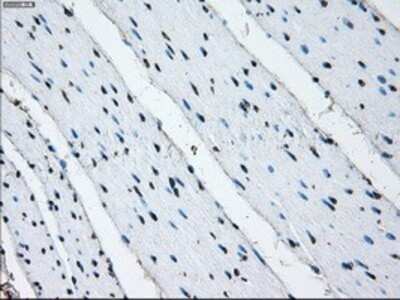 Immunohistochemistry: PSMA7 Antibody (OTI3F11) - Azide and BSA Free [NBP2-73693]