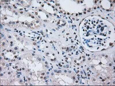 Immunohistochemistry: PSMA7 Antibody (OTI3F11) - Azide and BSA Free [NBP2-73693]