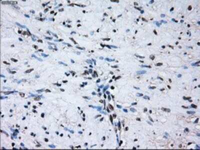Immunohistochemistry: PSMA7 Antibody (OTI3F11) - Azide and BSA Free [NBP2-73693]