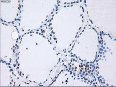 Immunohistochemistry: PSMA7 Antibody (OTI3F11) - Azide and BSA Free [NBP2-73693]
