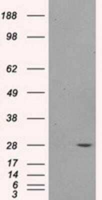 Western Blot: PSMA7 Antibody (OTI3F11)Azide and BSA Free [NBP2-73693]