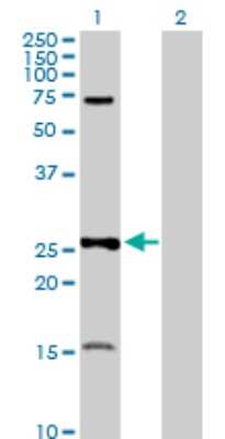 Western Blot: PSMA7 Antibody [H00005688-D01P]
